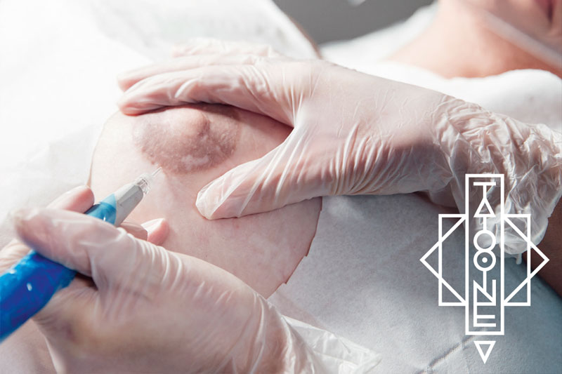 PARAMEDIZINISCHE PIGMENTIERUNG in Koblenz